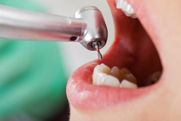 Best Broken or Cracked Tooth Emergency Dentist in Croydon, PA
